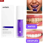 ¡Blanqueador Dental!
